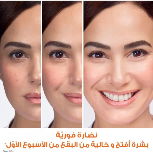 كريم النهار سكين اكتيف للتفتيح السريع مع 3x فيتامين سي والليمون من غارنييه - 100 مل
